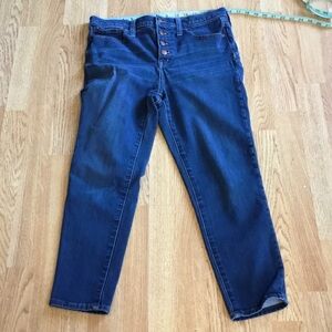 Madewell Dark Blue Skinny Jeans button closure